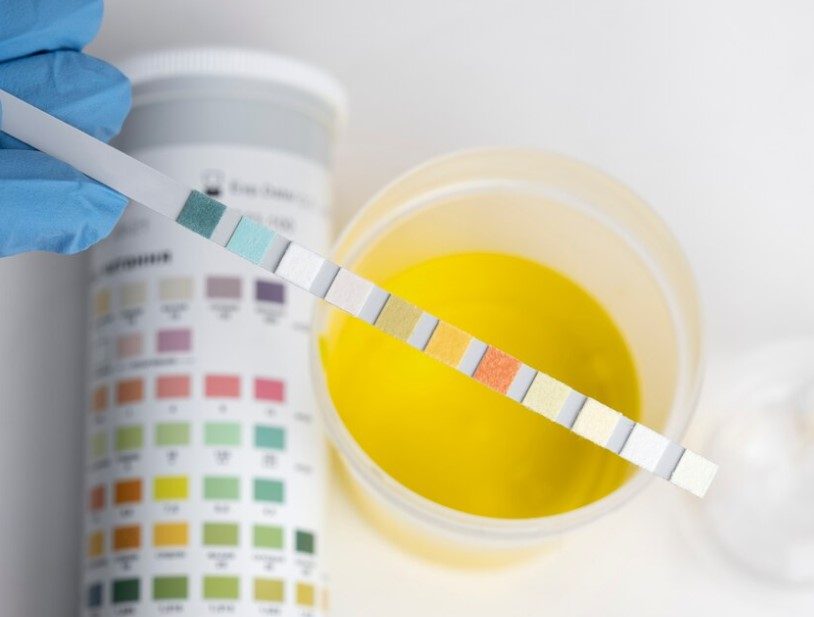 Urine Temperature for Drug Tests